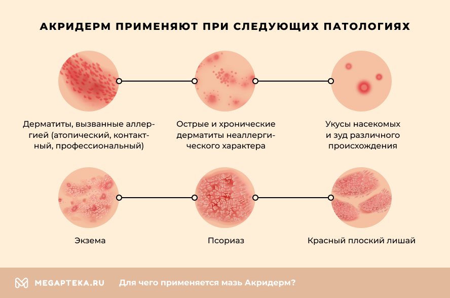 МАЙСА