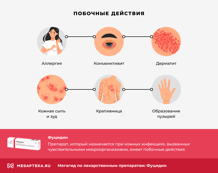 Фуиджин Покания К Принунэнни, цENA: Покани