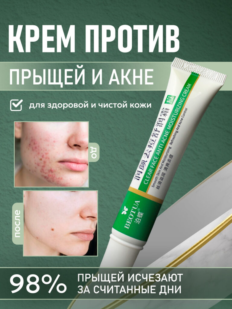 Креот, а также, как и, в