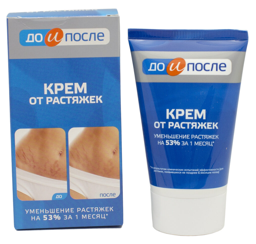 911 kreme otrasthastek & quot; opostere & quot; 